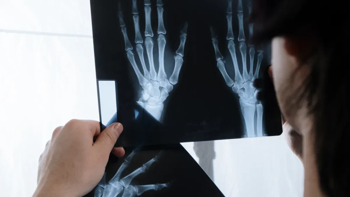 Understanding X-ray in SMT Processing