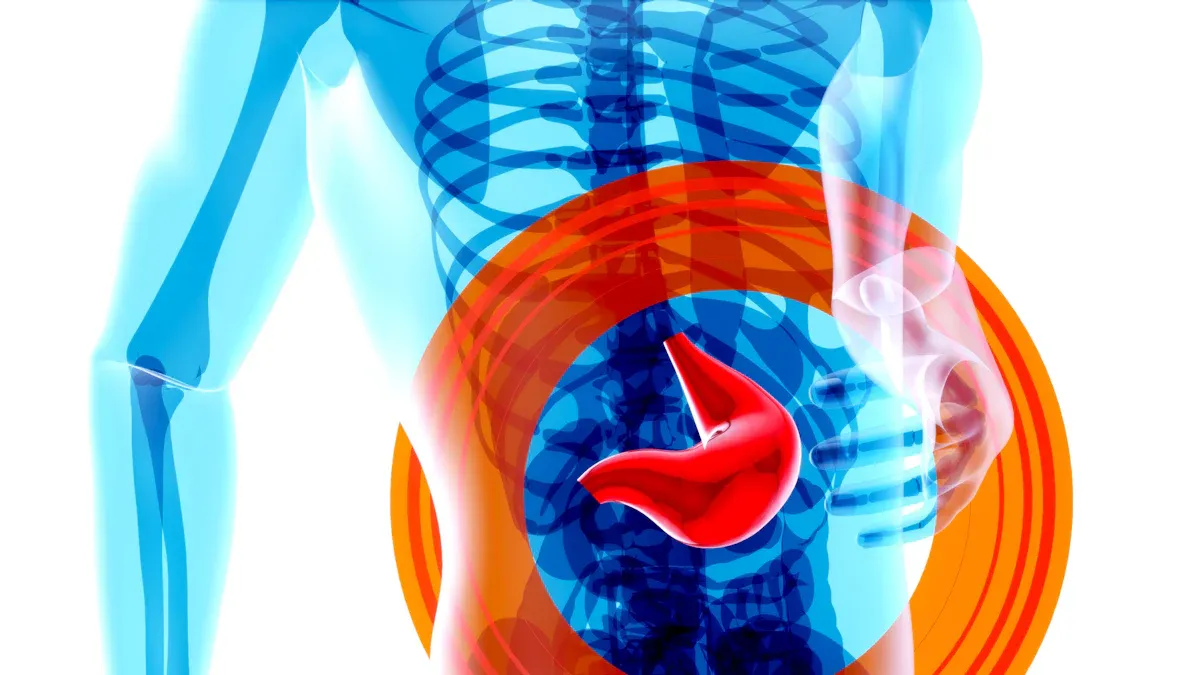 GERD and Calcium Citrate