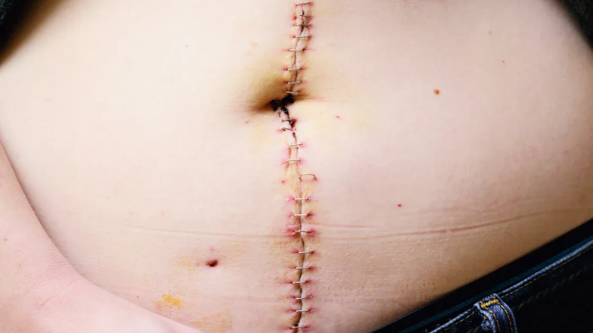 Warning Signs and When to Seek Help