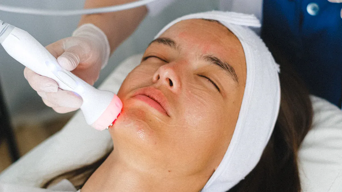How RF Microneedling Works for Skin Rejuvenation