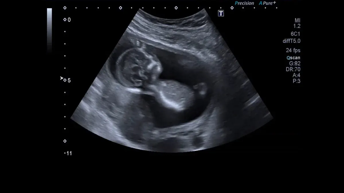 Types of Ultrasound Scan