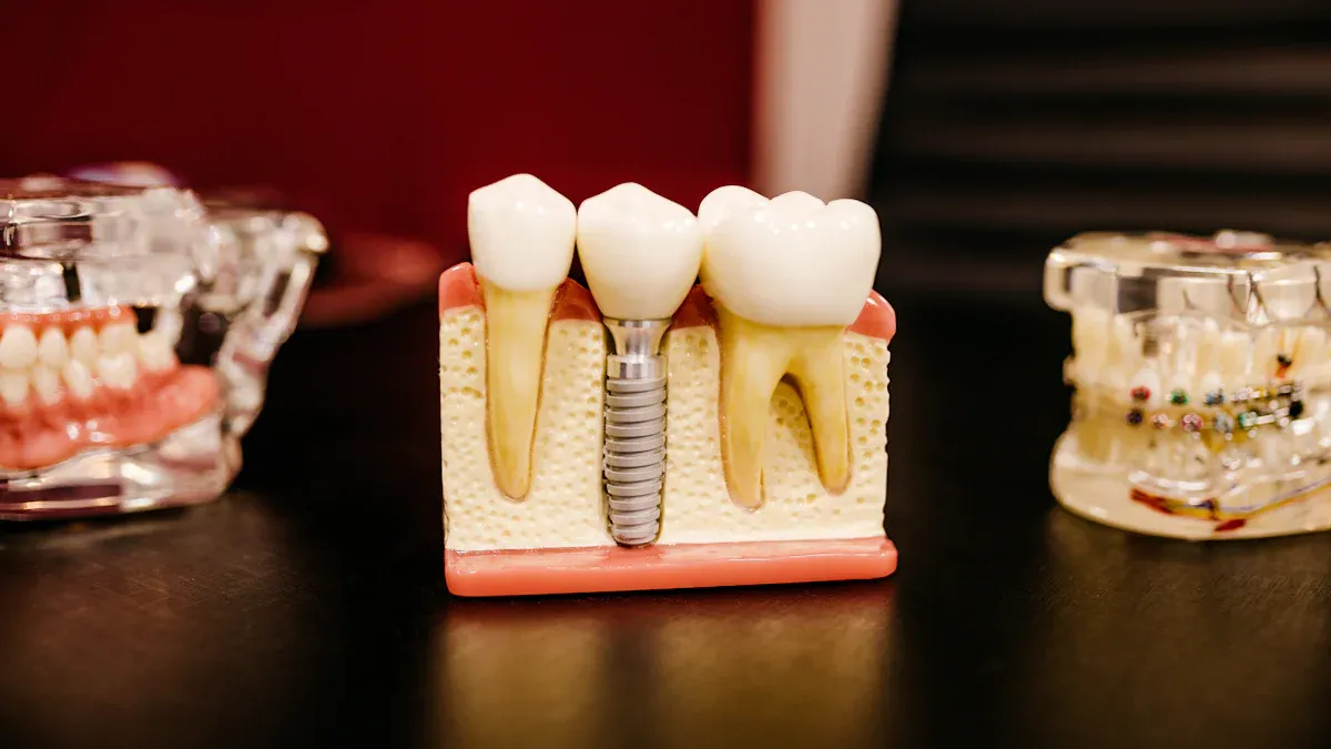 Beneficiile proteticii dentare