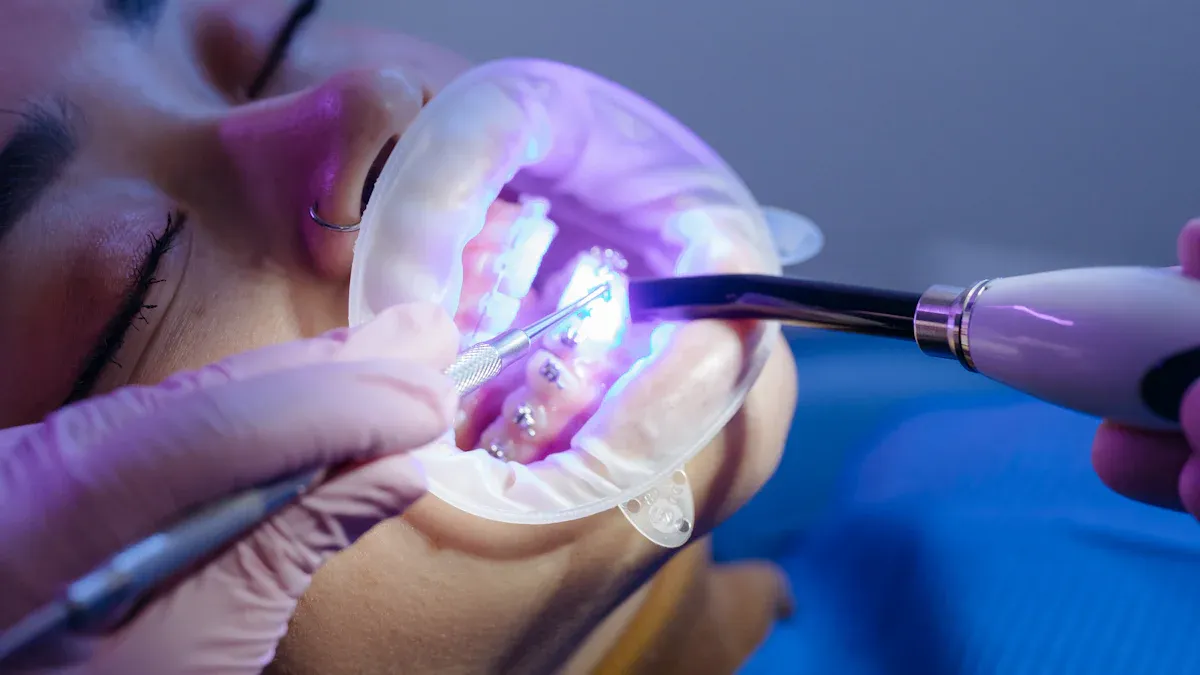 Tipurile tratamente stomatologice laser