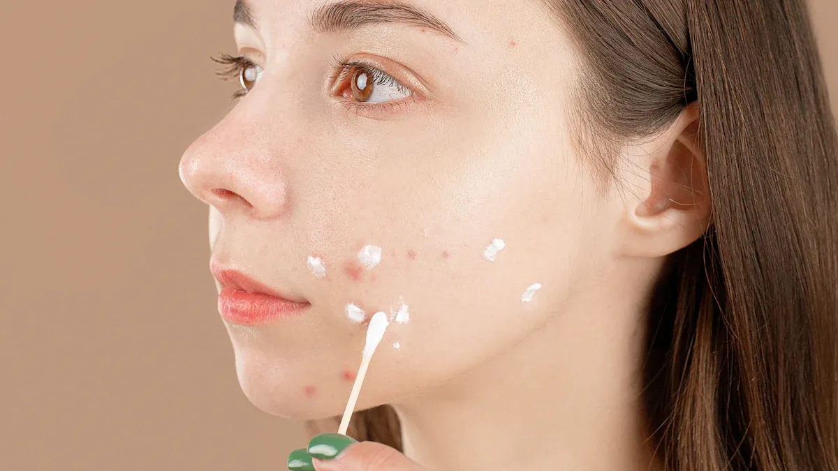 How to Use Hypochlorous Acid Mists for Acne