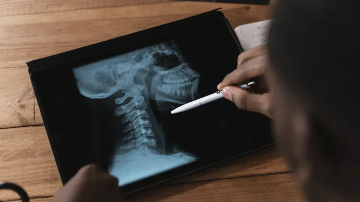 How Doctors Decide on Cervical Fusion