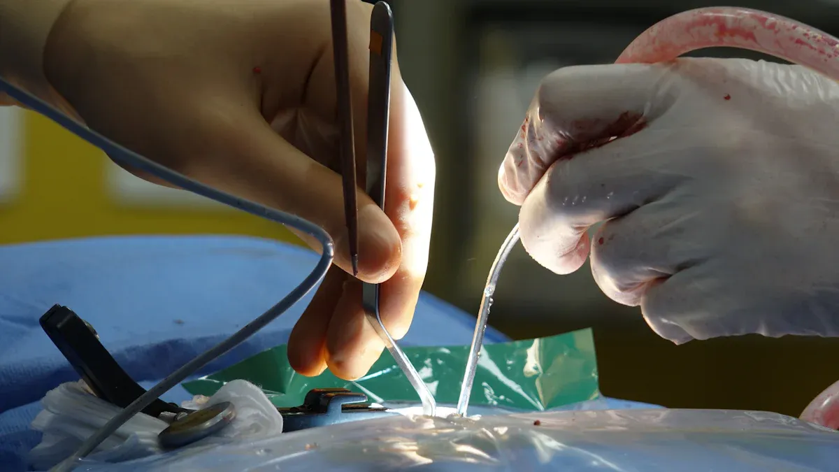 Interbody Cage Fusion ողնաշարի վիրաբուժության մեջ