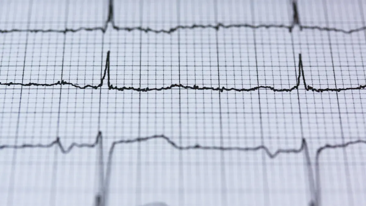 RMSSD vs SDNN Understanding Two HRV Metrics for Recovery and Long-Term Trends
