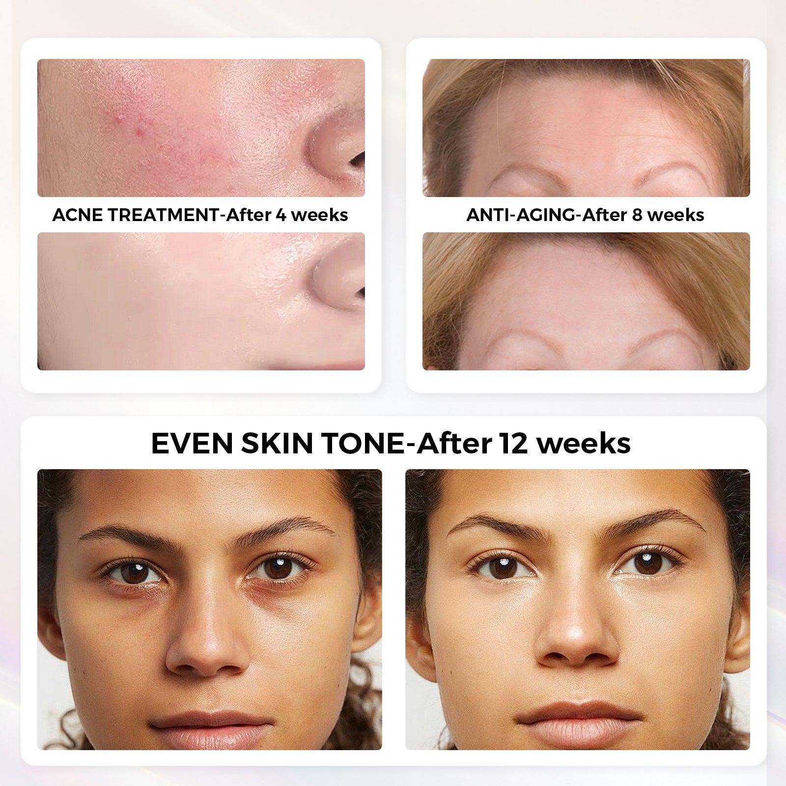 Results & Light Therapy Benefits