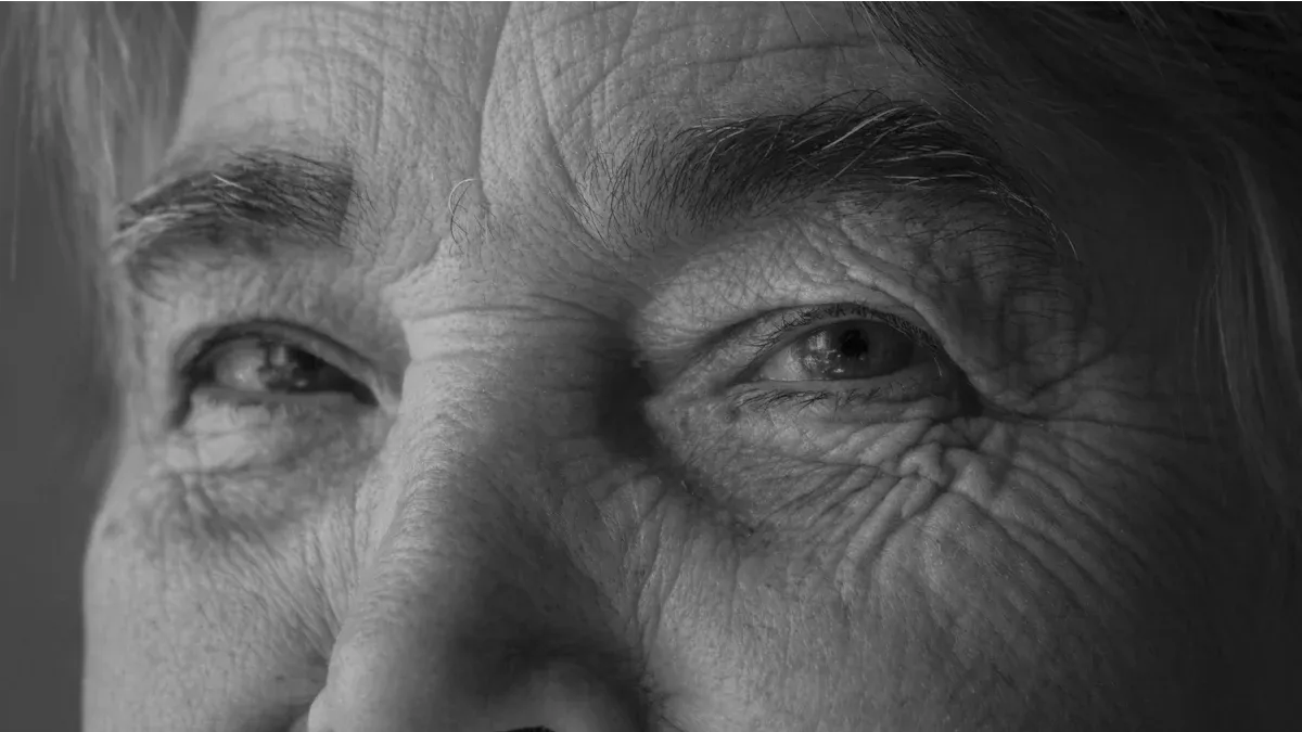 Understanding the Triple Threat | Dark Circles and Puffiness