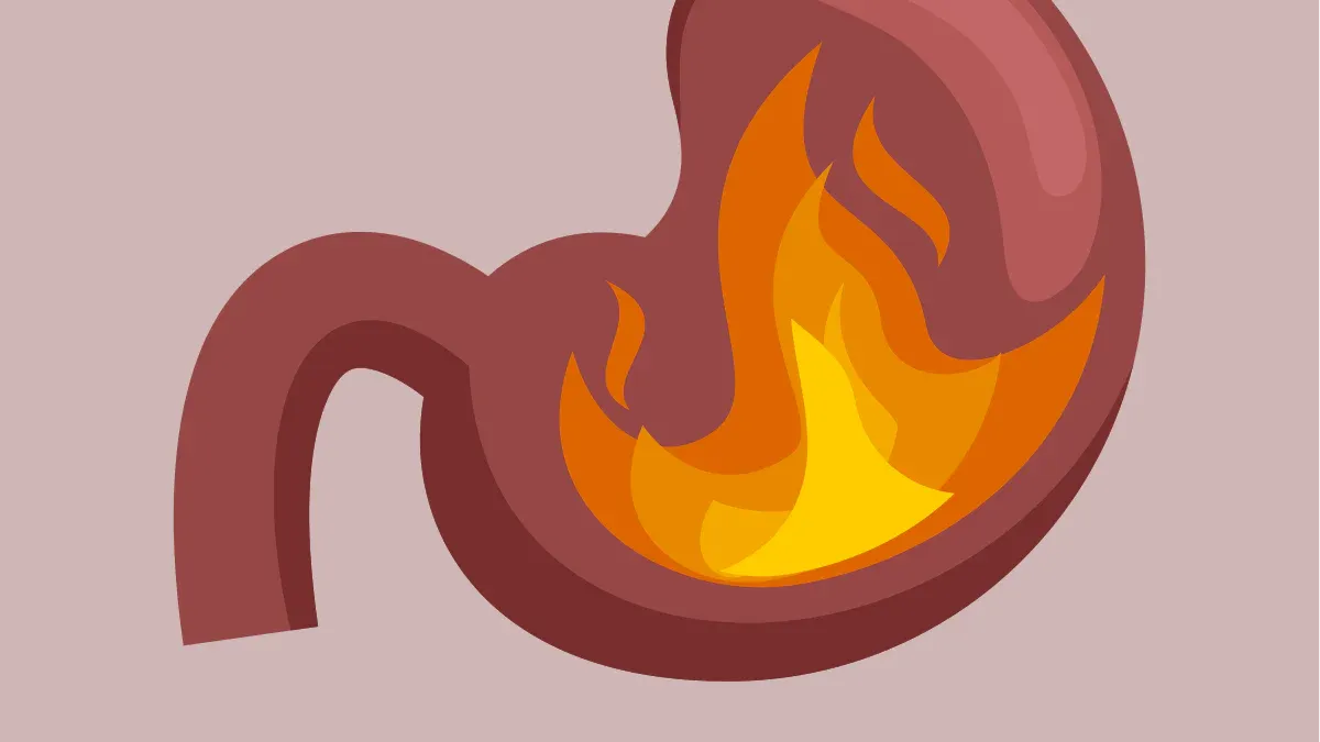 Quick Relief for Stomach Acid