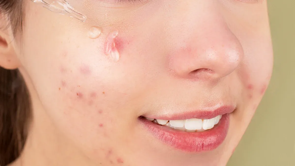 Identifying Skin Concerns and applying corrective serum