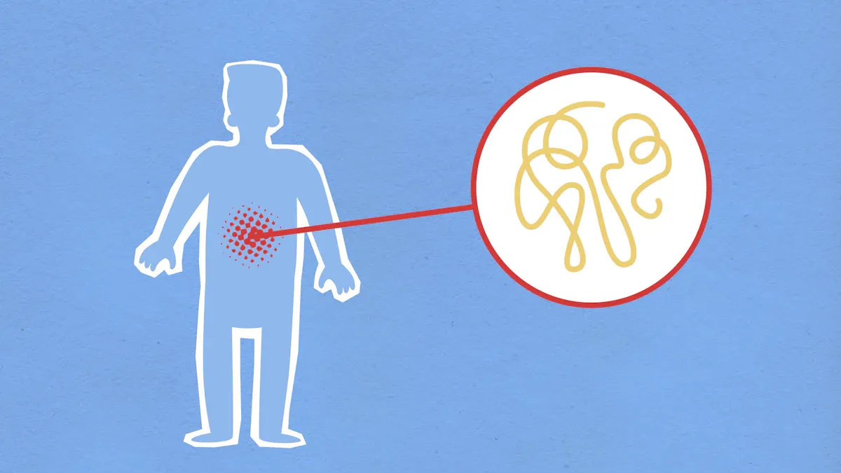 Gut-Skin Connection and Dermatitis