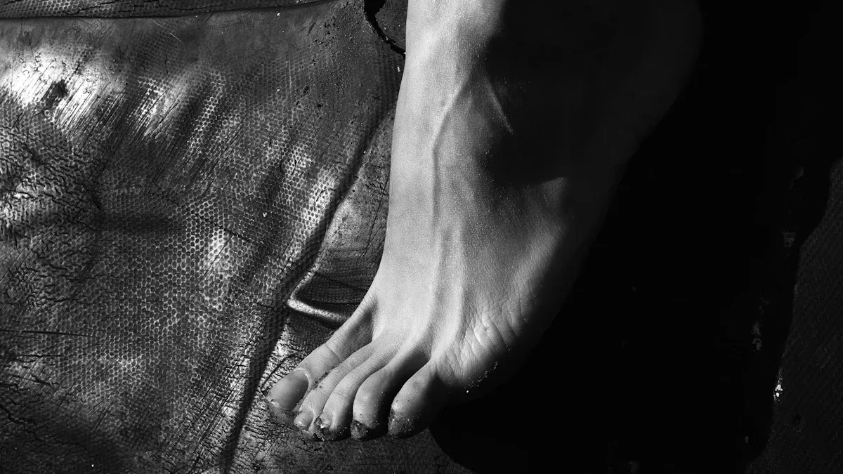 Varicose Veins Overview