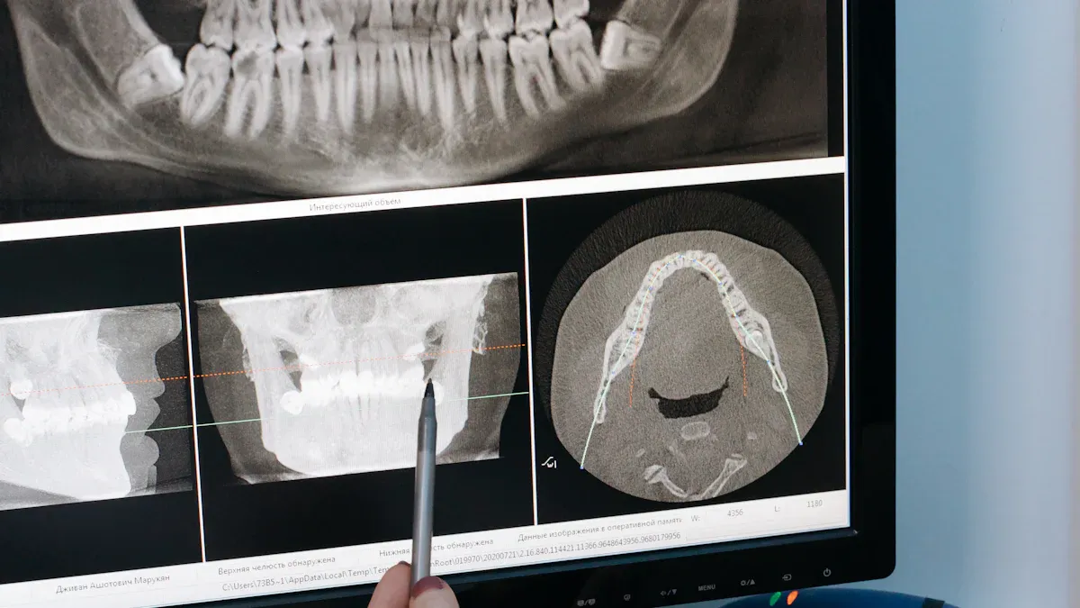 Radiologie Dentară Cluj