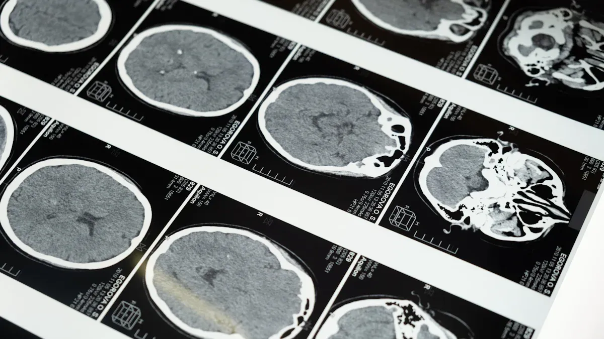 The Role of Imaging in Cancer Diagnosis: X-Rays