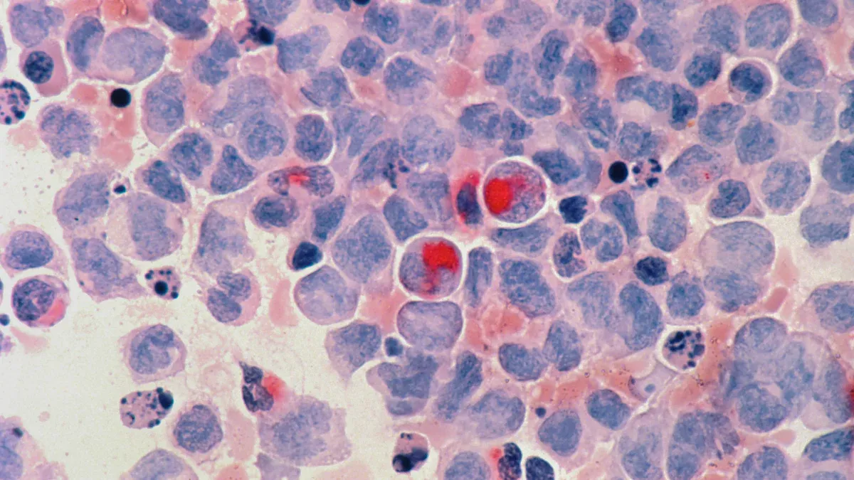 How Tumors Are Graded