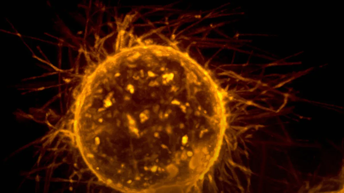 Why Do Some Cancers Spread Faster Than Others?