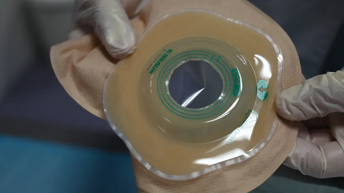 How to Adjust to Life with a Stoma in 2025