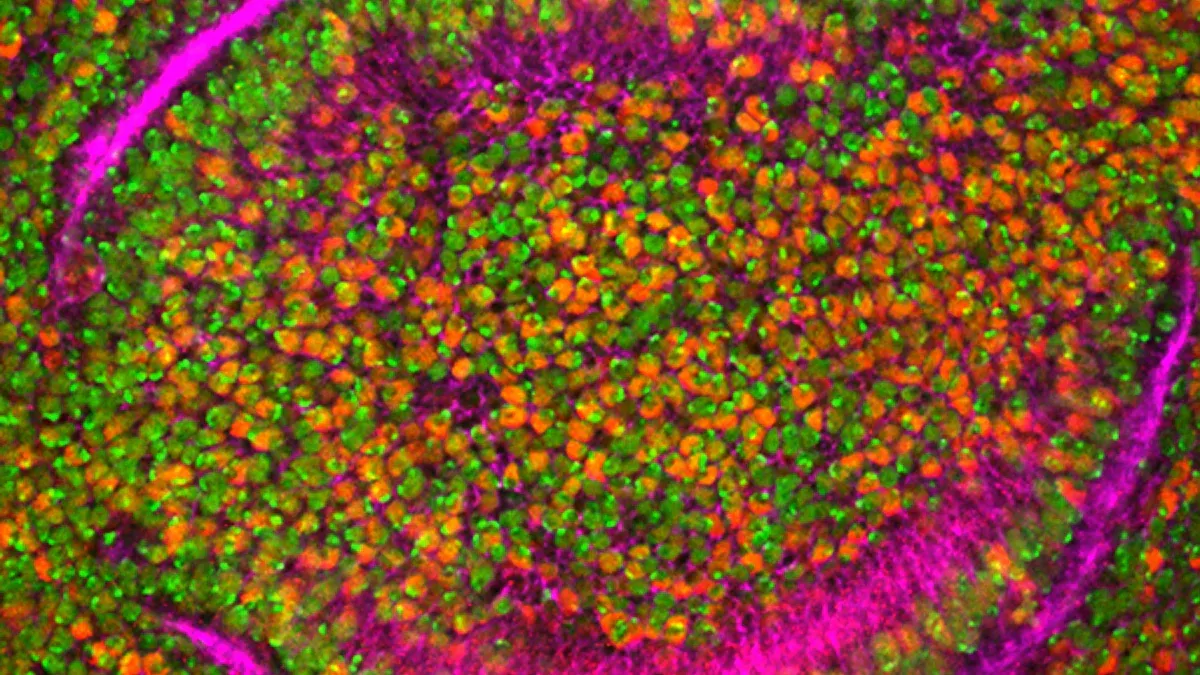 Mechanisms of vitamin B5 in cancer