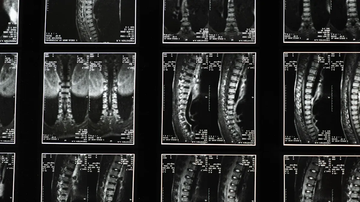 Diagnostic Methods to Confirm If a Tumor Is Cancerous
