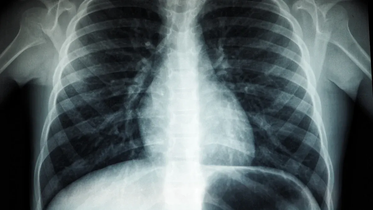 How CT Scans Work and Their Applications in Cancer Diagnosis