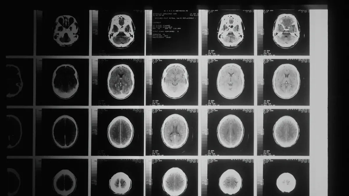 How Aggressiveness Impacts Treatment and Prognosis