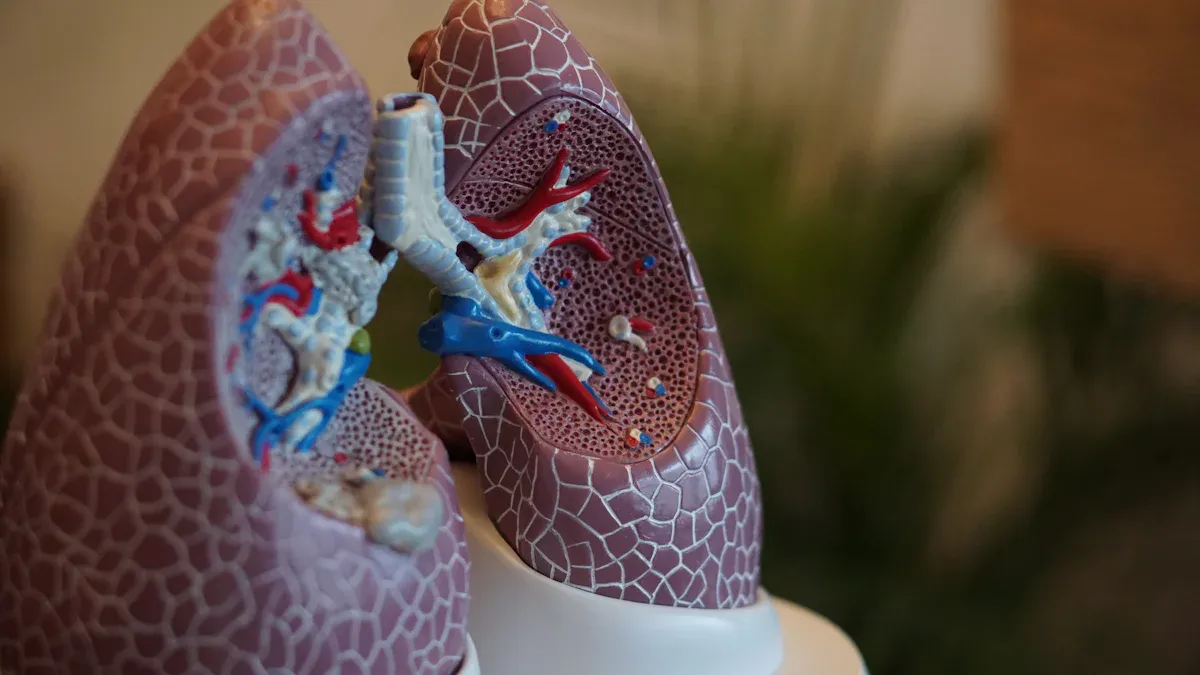 Causes of Lung Cancer in Non-Smokers
