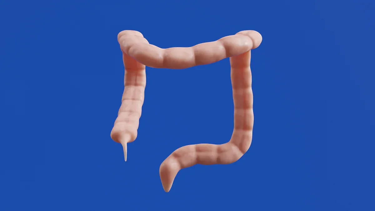 TTX-MC138 Clinical Trial in Colorectal Cancer: Design & Overview