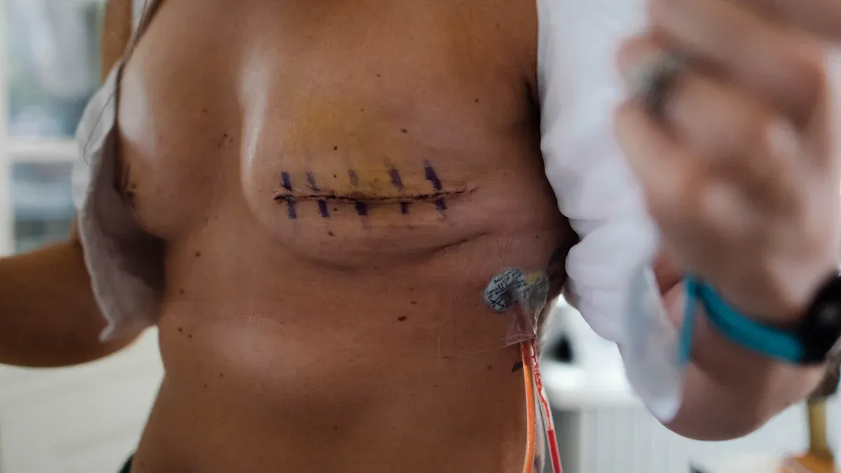 How Benign Tumors Cause Problems
