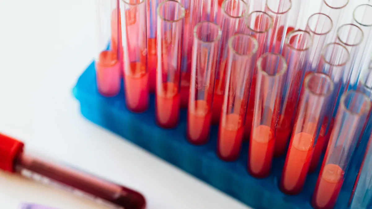 How to Understand Your Blood Test Results