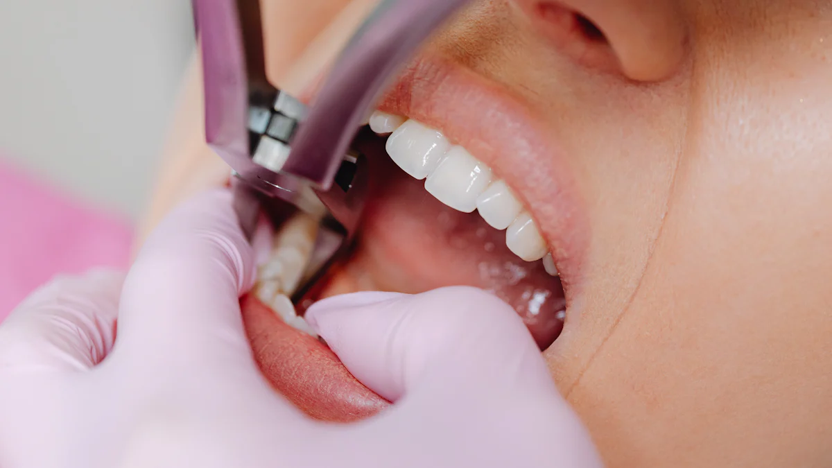What is Kin Gingival Complex and Why It Matters
