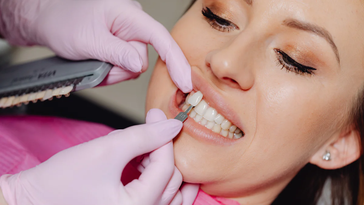 What Are Gingival Veneers and Their Benefits