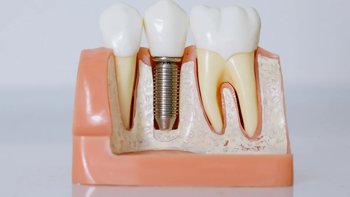 What Is Free Gingival Graft and Why It Matters