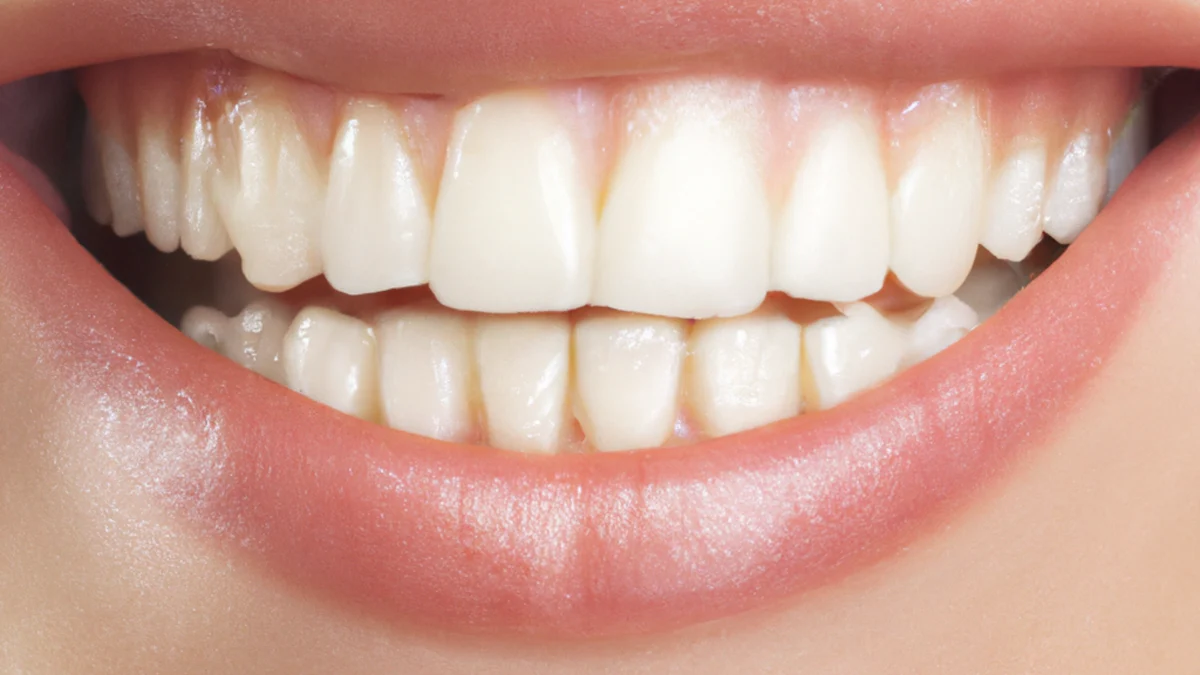 Sonrisa gingival explained and what causes it