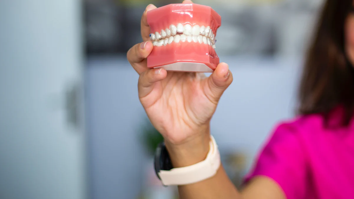 What Are Gingiva Masks and Their Role in Modern Dentistry