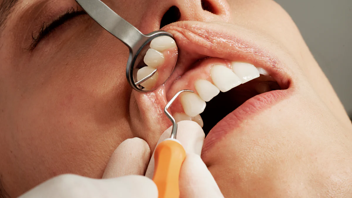 What Are Gingival Embrasures and Why Are They Important
