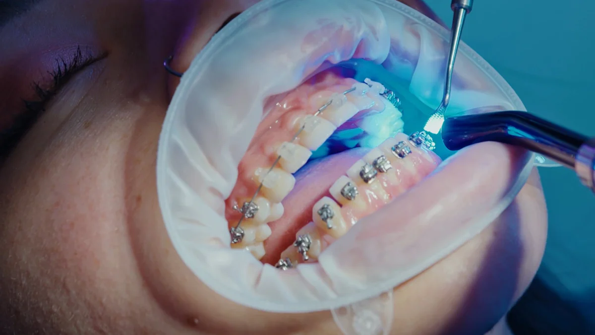 Gum Graft Problems? Learn How to Spot and Fix Them