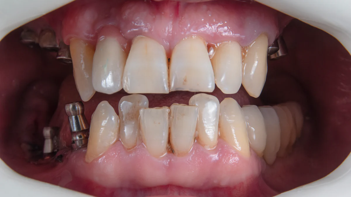 Understanding the Free Gingival Groove and Its Role in Oral Health