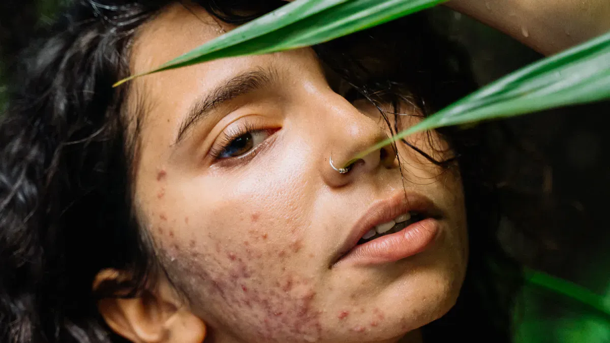 Effets secondaires et précautions