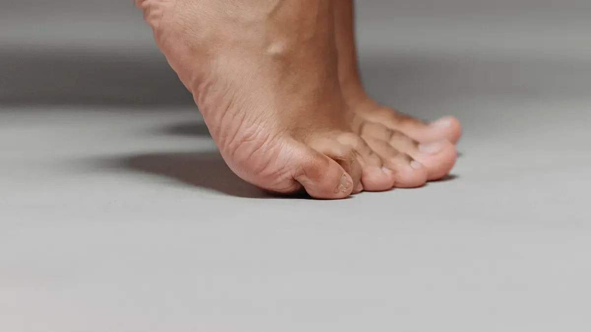 Compression Socks for Gout Relief