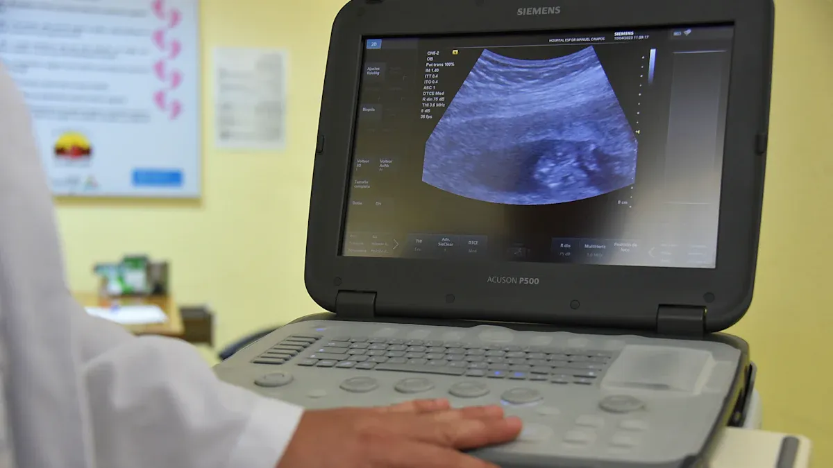 Understanding Sonograms