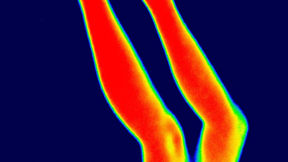 Heat Control and Searchlight Performance