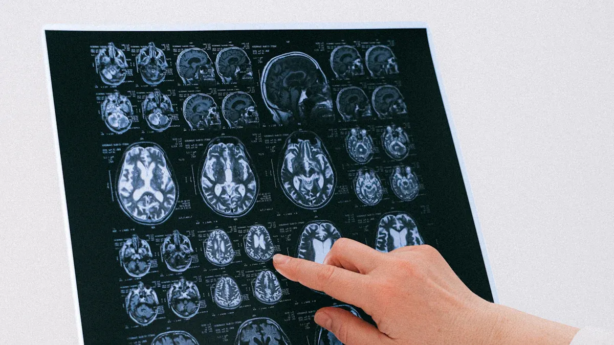 Microstructure of Permanent Magnets