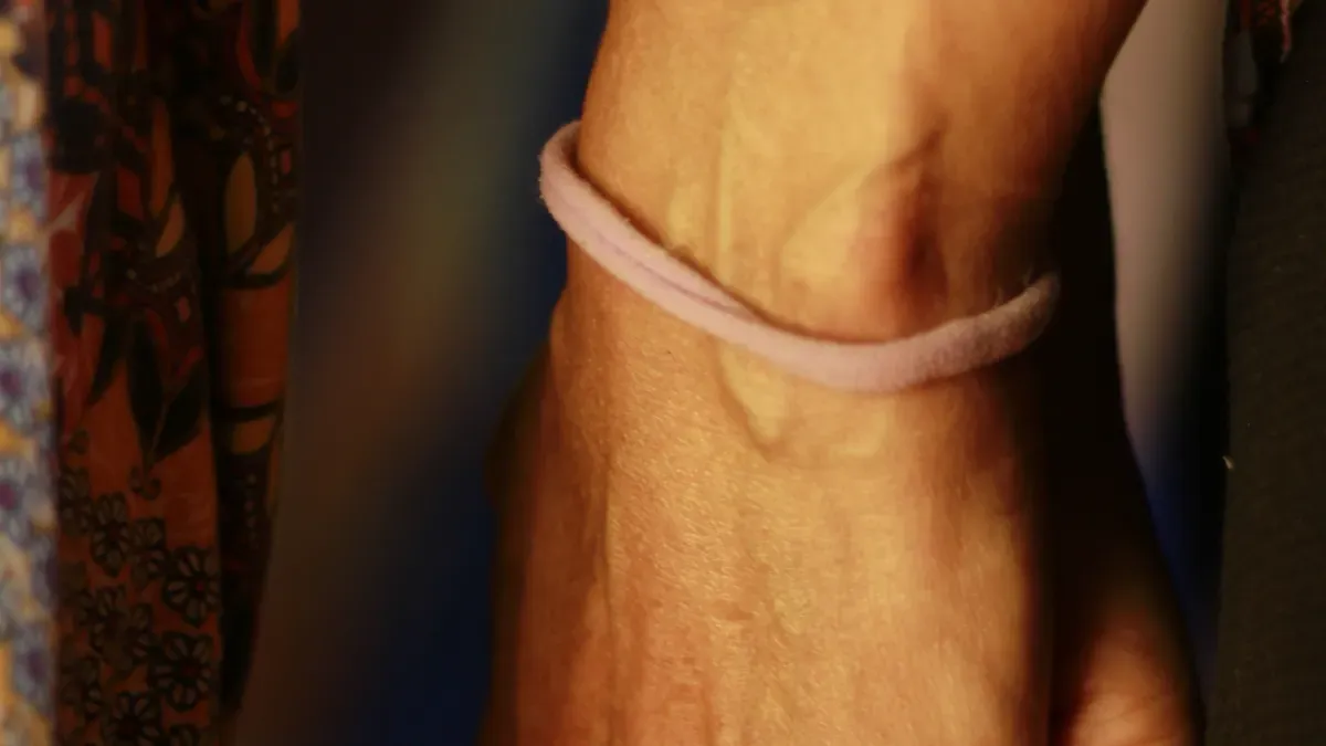 Wat is carboxy-getermineerd nitril-butadieenrubber?