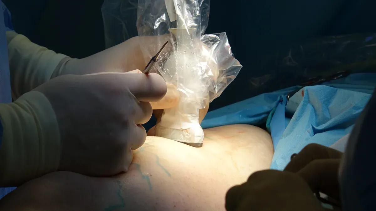 The Role of Specimen Retrieval Bags in Laparoscopic Surgery