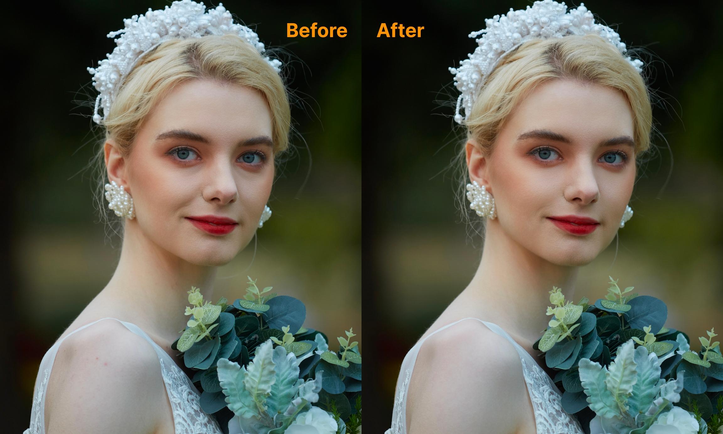 7b9775c1ddd54efda03091531728ecaf Blemish Remover vs Old Retouching