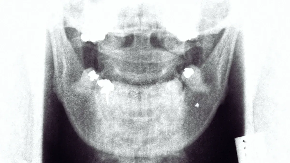 Symptoms of TMJ Headaches
