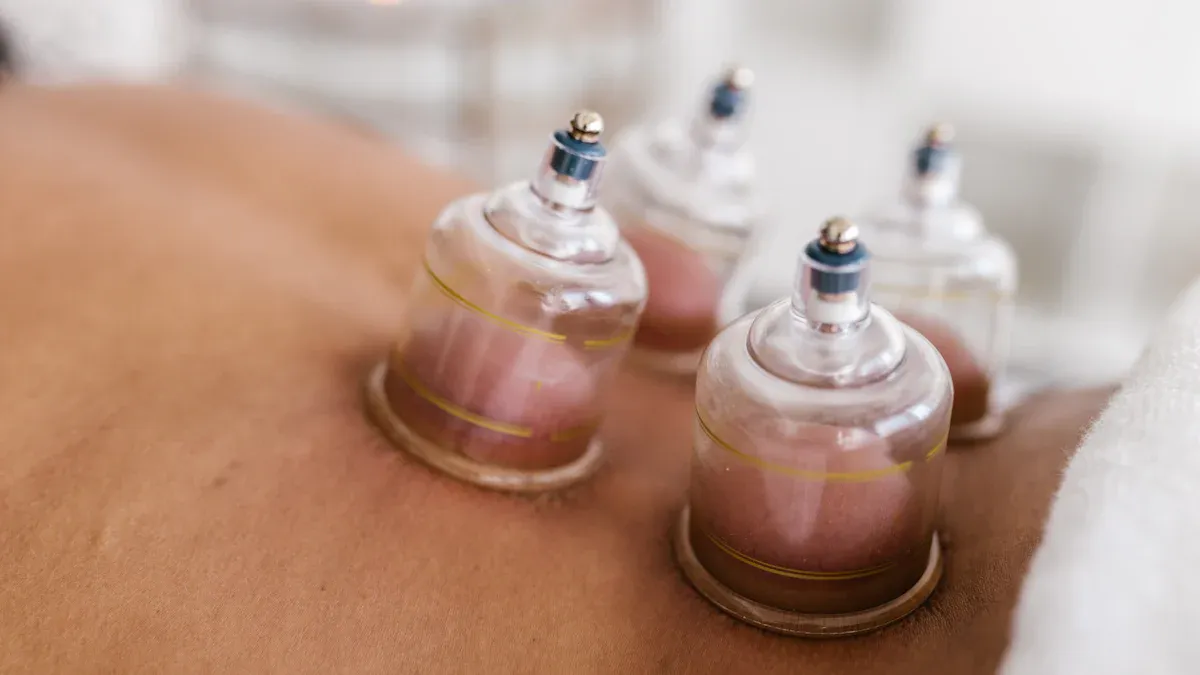 What is Dry Cupping?