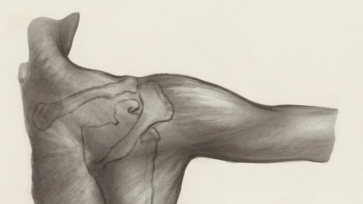 What is a glenoid labrum tear?