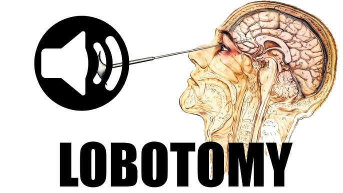 Never Miss Free Lobotomy Sound Effects Again